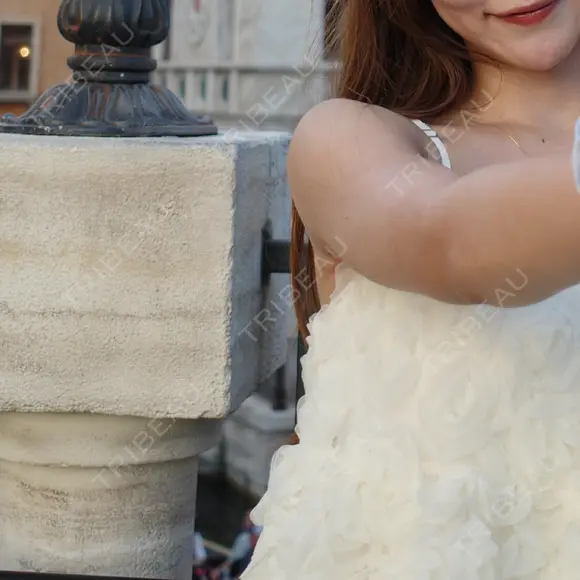 インディバ（二の腕） 渋谷美容外科クリニック 池袋院 AFTER メイン用