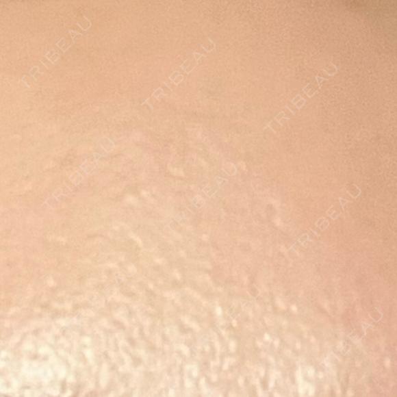 高濃度ビタミンC点滴 新宿美容外科ネビュラクリニック DAY 8 メイン用