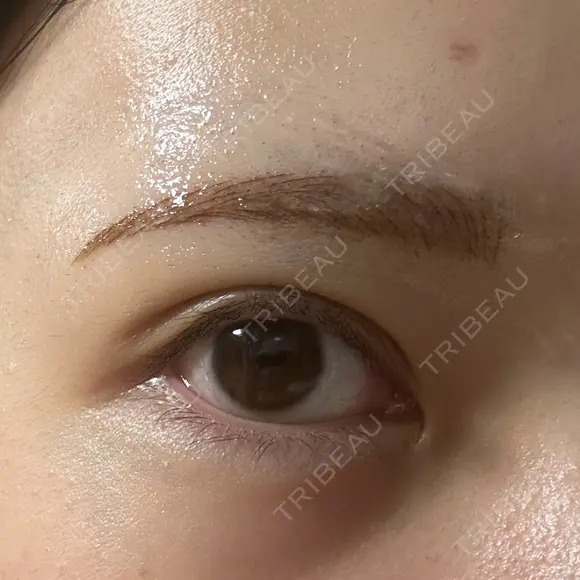 アートメイク（眉） Kinshicho Beauty Clinic （錦糸町ビューティークリニック） DAY 1 メイン用