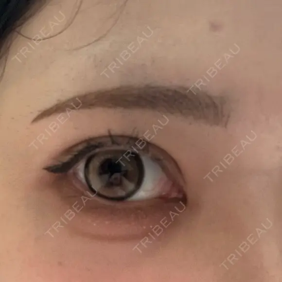 アートメイク（眉） Kinshicho Beauty Clinic （錦糸町ビューティークリニック） DAY 3 メイン用
