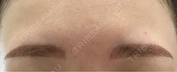 白玉点滴・注射 / アートメイク（眉） 表参道メディカルクリニック 名古屋院 AFTER メイン用