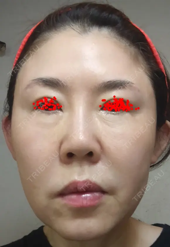 白玉点滴・注射 城本クリニック 大阪院 DAY -2 メイン用