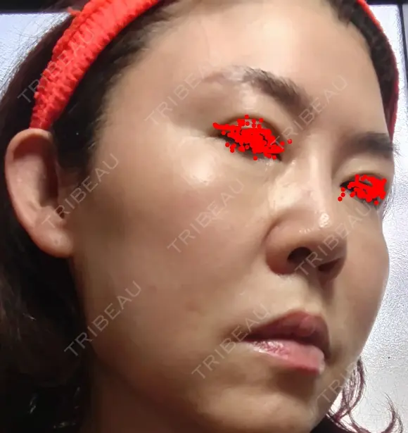 白玉点滴・注射 城本クリニック 大阪院 DAY 1 メイン用