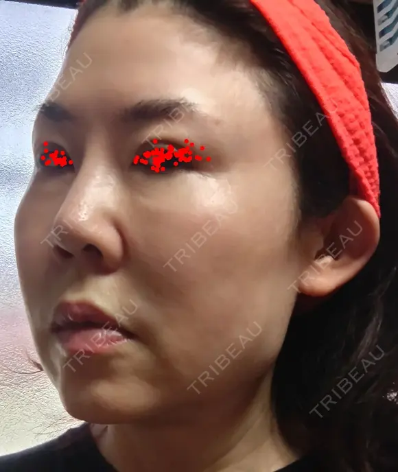 白玉点滴・注射 城本クリニック 大阪院 DAY 1 メイン用