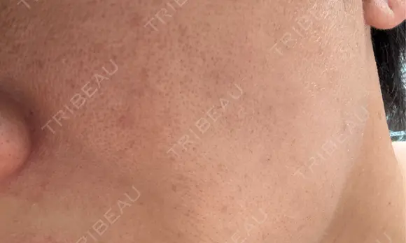 ルメッカ / ミラノリピール ON-CLINIC Beauty DAY 7 メイン用