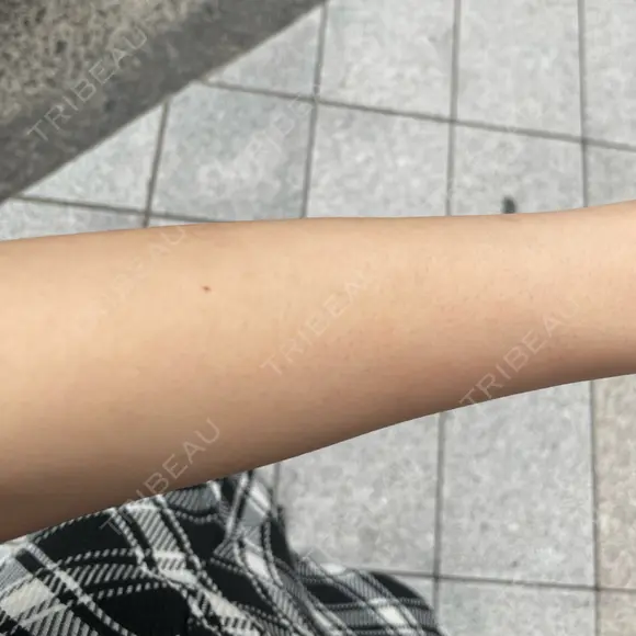 医療脱毛（腕） / 医療脱毛（脚） 表参道メディカルクリニック 新宿院 AFTER メイン用