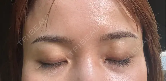 アートメイク（眉） 表参道メディカルクリニック 広島院 DAY 4 メイン用