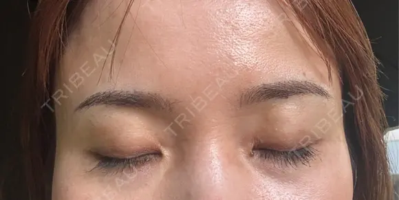 アートメイク（眉） 表参道メディカルクリニック 広島院 DAY 6 メイン用