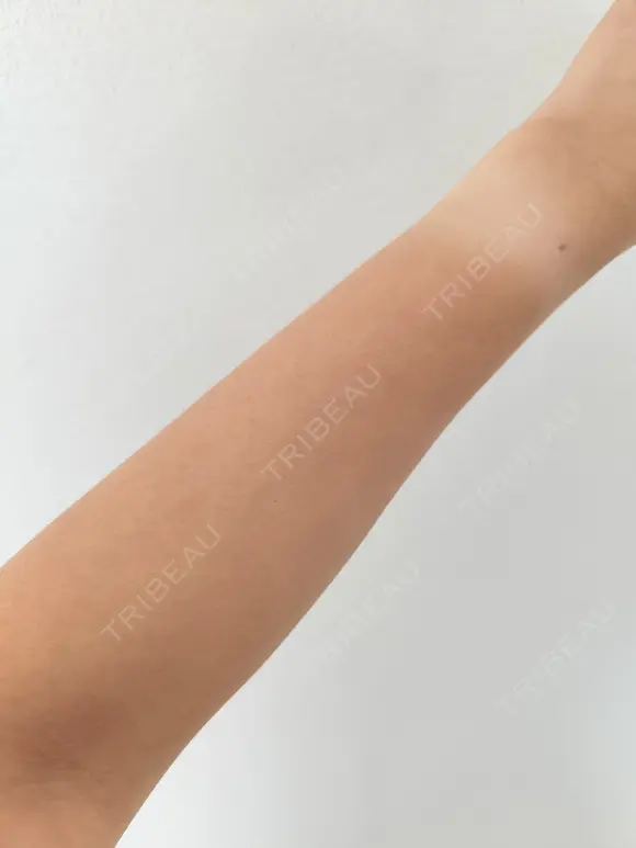 白玉点滴・注射 城本クリニック 大阪院 AFTER メイン用