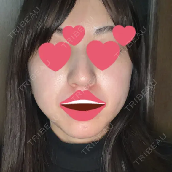 オンダリフト LIGHT CLINIC 【ライトクリニック】 名古屋院 DAY 0 メイン用