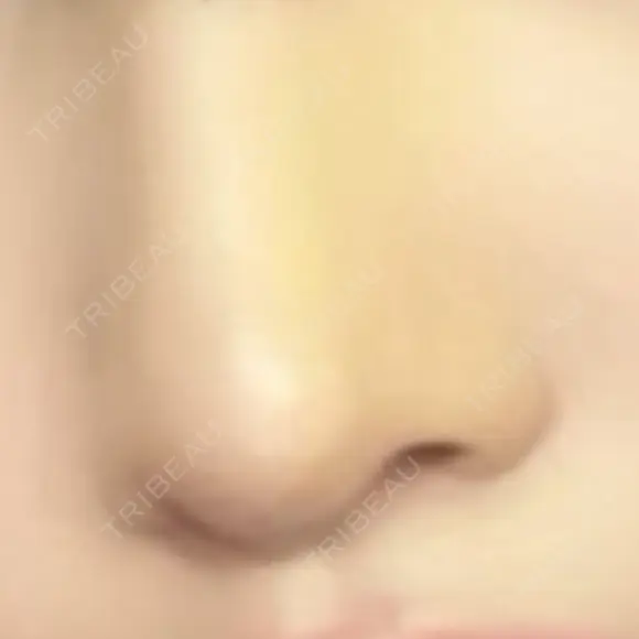 鼻尖形成（切開） / 小鼻縮小（切開） / 軟骨移植 / 鼻柱下降・鼻唇角形成（猫手術） / ボトックス（エラ・小顔） ASTRA BEAUTY CLINIC DAY 69 メイン用