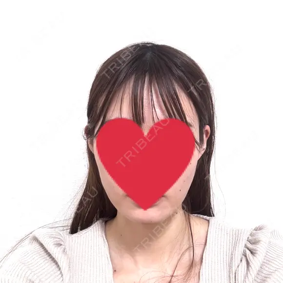 糸リフト / 脂肪吸引（顔） / ボトックス（エラ・小顔） Wing clinic 豊中駅前院 DAY 1 メイン用