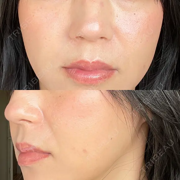 ヴェルヴェットスキン RainBoW Clinic TOKYO DAY 2 メイン用