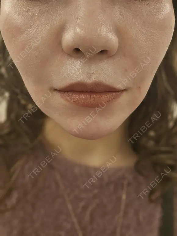 その他 MKクリニック 日本橋院 DAY 0 メイン用