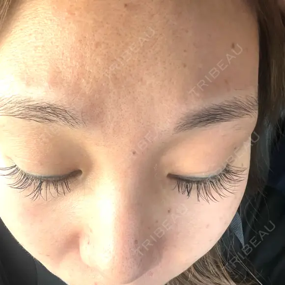 ルメッカ J CLINIC DAY 7 メイン用