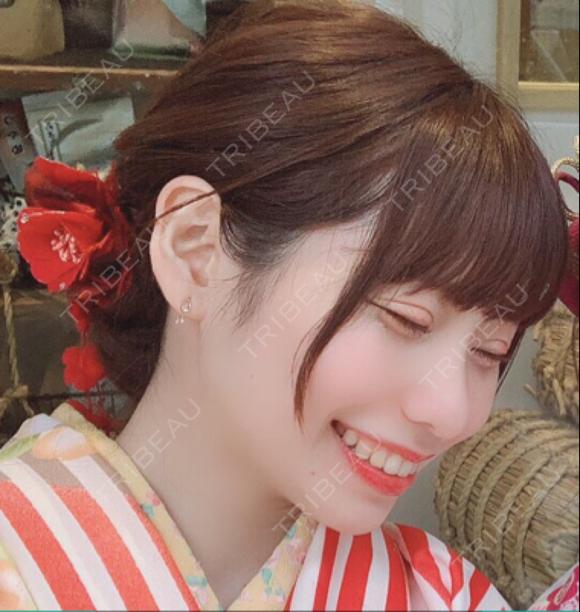 二重切開 / 目頭切開 湘南美容クリニック 池袋西口院 DAY 319 メイン用