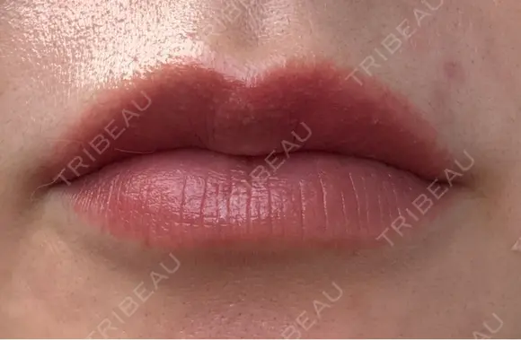アートメイク（唇） セカジソウォン医院-明洞店 AFTER メイン用