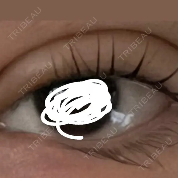 二重埋没 / 自然癒着法 形成外科と美容外科のクリニック池袋 AFTER メイン用