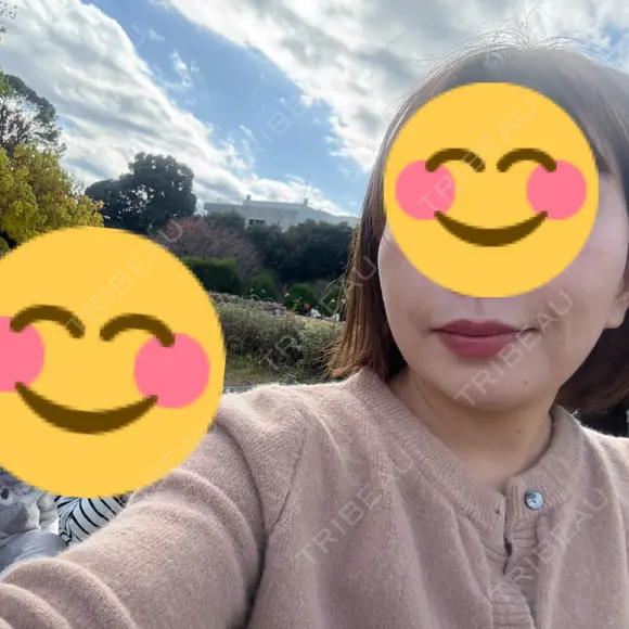 糸リフト Days Beauty Clinic 本厚木院 DAY 15 メイン用