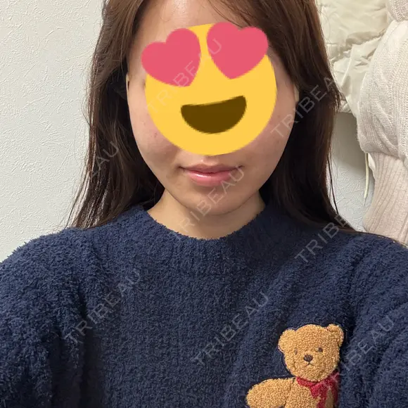 糸リフト 形成外科と美容外科のクリニック池袋 DAY 0 メイン用