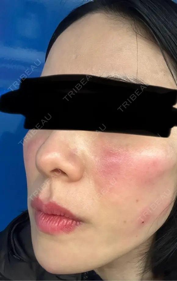 ジャルプロ ウィルビークリニック 新宿院 DAY 0 メイン用