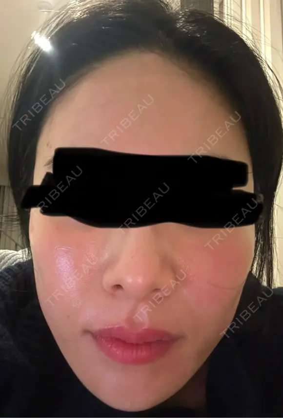 ジャルプロ ウィルビークリニック 新宿院 DAY 1 メイン用