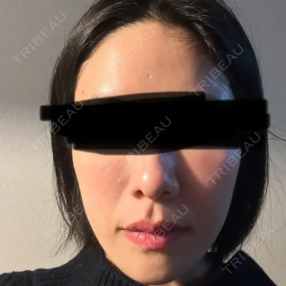 ジャルプロ ウィルビークリニック 新宿院 DAY 2 メイン用