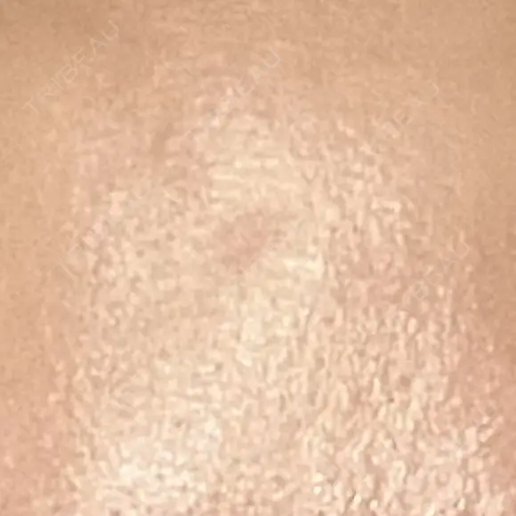 プラセンタ注射 新宿駅三丁目クリニック DAY 5 メイン用