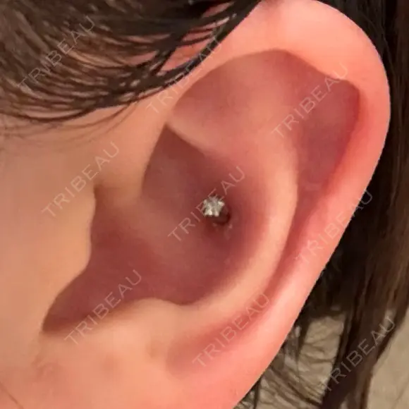 ピアス穴あけ 渋谷美容外科クリニック 新橋院 AFTER メイン用