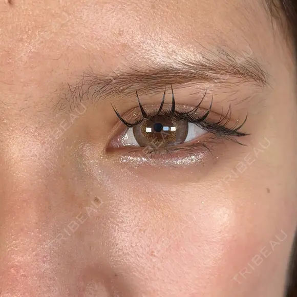 二重埋没 / 上まぶたの脂肪取り / 口角挙上 / ヒアルロン酸注入（涙袋） / ボトックス（エラ・小顔） / ヒアルロン酸注入（唇） / ボトックス（肩） アリエル美容クリニック 大宮院 DAY 44 メイン用