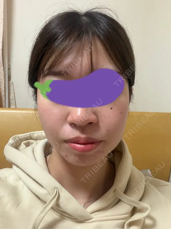 オンダリフト LIGHT CLINIC 【ライトクリニック】 名古屋院 DAY 0 メイン用