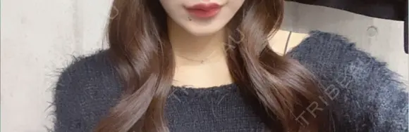 ボトックス（口角） PRO CLINIC プロクリニック 銀座院 AFTER メイン用