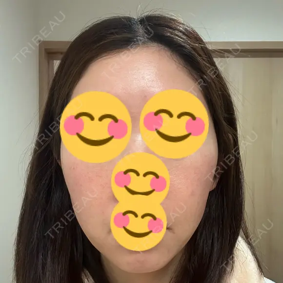 インモード Moon Beauty Clinic DAY 6 メイン用