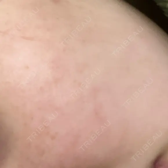 ルメッカ 大美会クリニック 京都烏丸院 AFTER メイン用