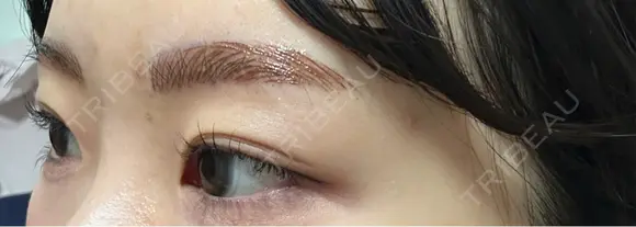 アートメイク（眉） G MEDICAL ART クリニック 新宿院 DAY 0 メイン用