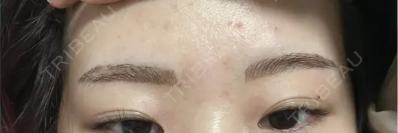 アートメイク（眉） G MEDICAL ART クリニック 新宿院 DAY 4 メイン用