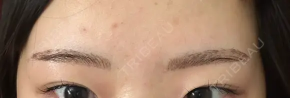 アートメイク（眉） G MEDICAL ART クリニック 新宿院 DAY 6 メイン用