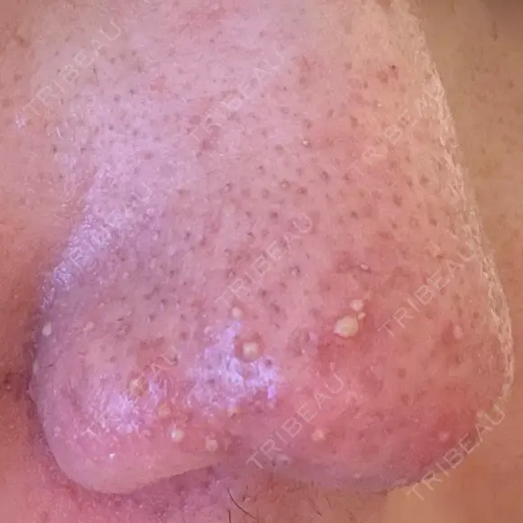 アグネス 日本美容・医療クリニック 六本木院 DAY 2 メイン用