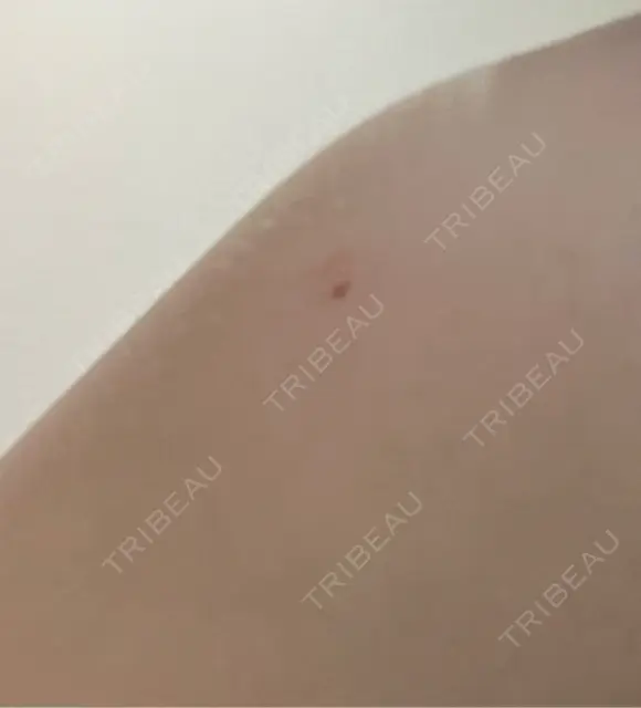 プラセンタ注射 吉祥寺アイビークリニック AFTER メイン用