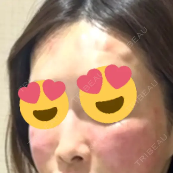 デンシティ Lumiera Clinic AFTER メイン用