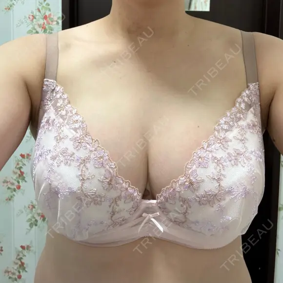 豊胸（シリコン＋脂肪併用） さくらバストクリニック AFTER メイン用