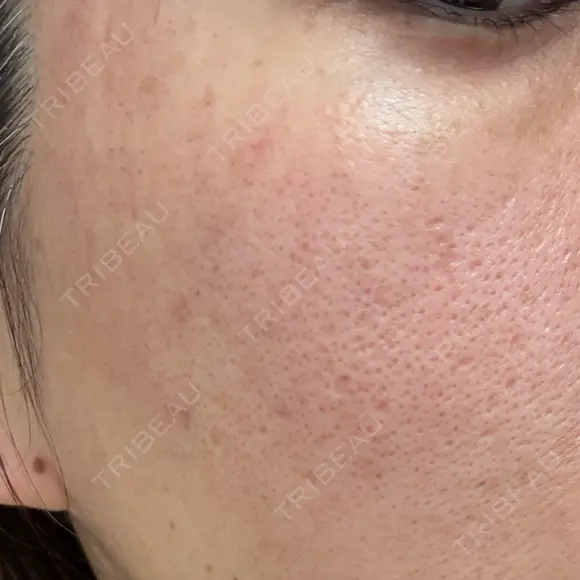 ポテンツァ 大美会クリニック 岡山院 DAY 1 メイン用