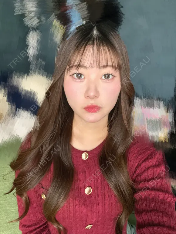 糸リフト / 脂肪吸引（顔） / ジョールファット除去 / ヒアルロン酸注入（あご） / ボトックス（エラ・小顔） 新宿美容外科ネビュラクリニック DAY 12 メイン用