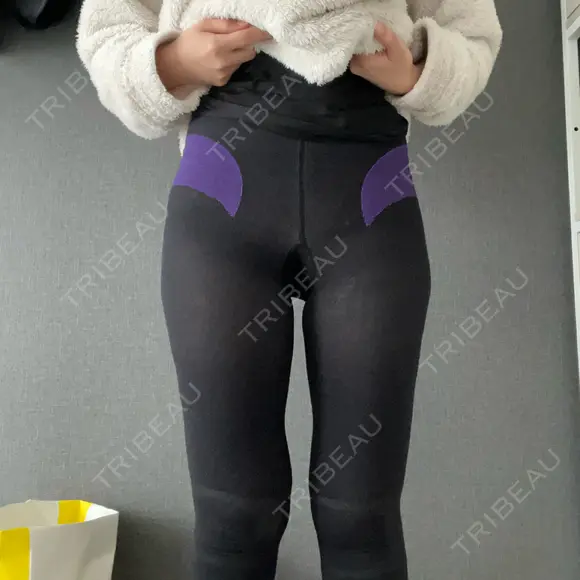 脂肪吸引（脚） GAYA body design clinic DAY 2 メイン用