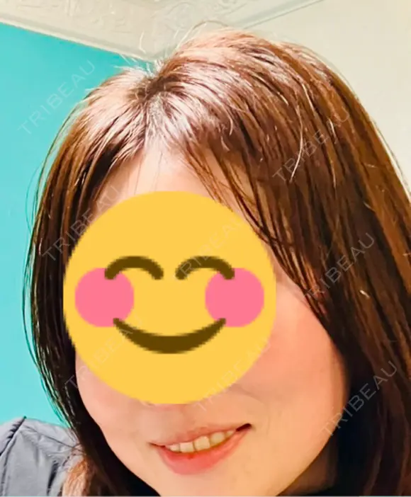 イオン導入 ルラ美容クリニック 郡山院 AFTER メイン用