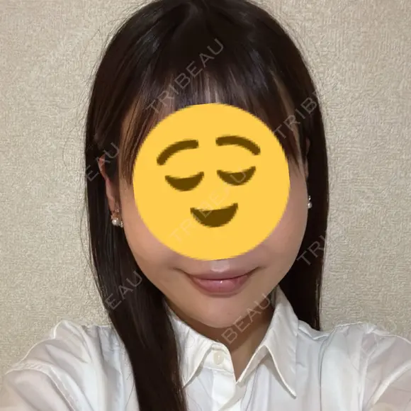 ハイフ（顔） 表参道メディカルクリニック 新宿院 AFTER メイン用