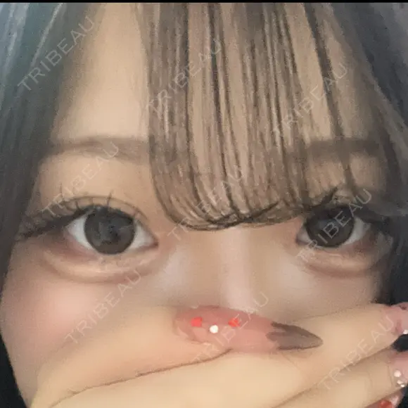 目頭切開 新宿美容外科ネビュラクリニック AFTER メイン用