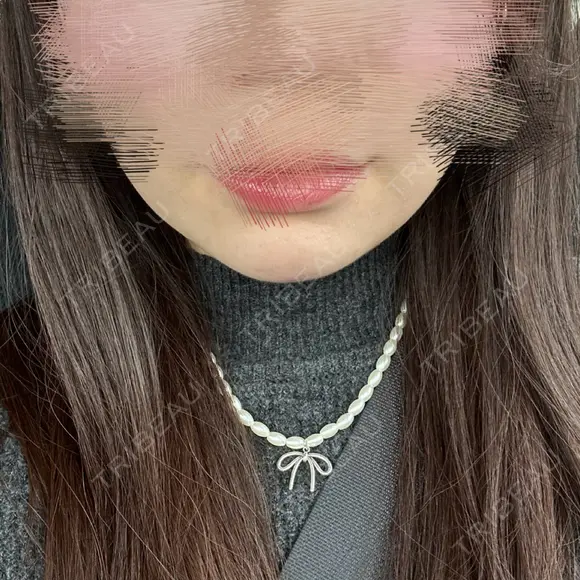 ボトックス（エラ・小顔） / RF（高周波）たるみ治療 大美会クリニック 梅田院 AFTER メイン用