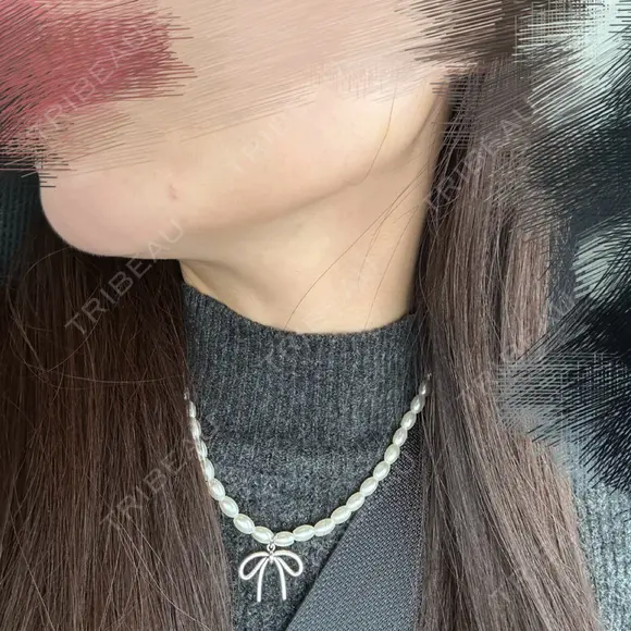 ボトックス（エラ・小顔） / RF（高周波）たるみ治療 大美会クリニック 梅田院 DAY 10 メイン用