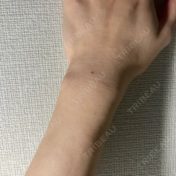 医療脱毛（顔） / 医療脱毛（全身） おおかみ美容のクリニック 横浜院 DAY 0 メイン用